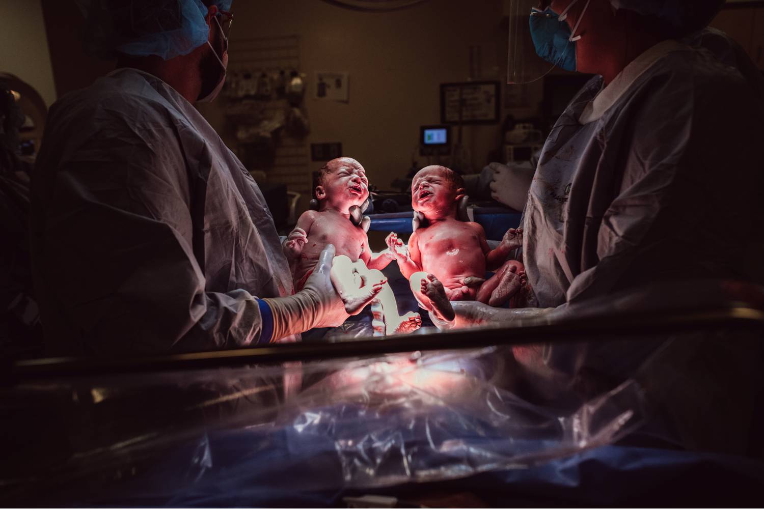Twin newborns are held up toward the light by the physicians who delivered them.